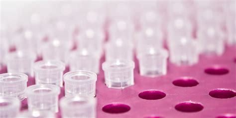 journey of a pipette tip|timeline of the pipette.